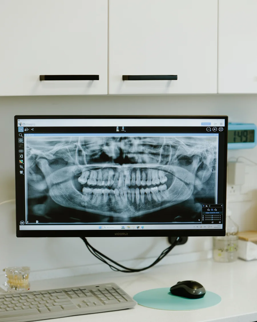 Radiographie panoramique numérique affichée à l'écran dans une salle de soins